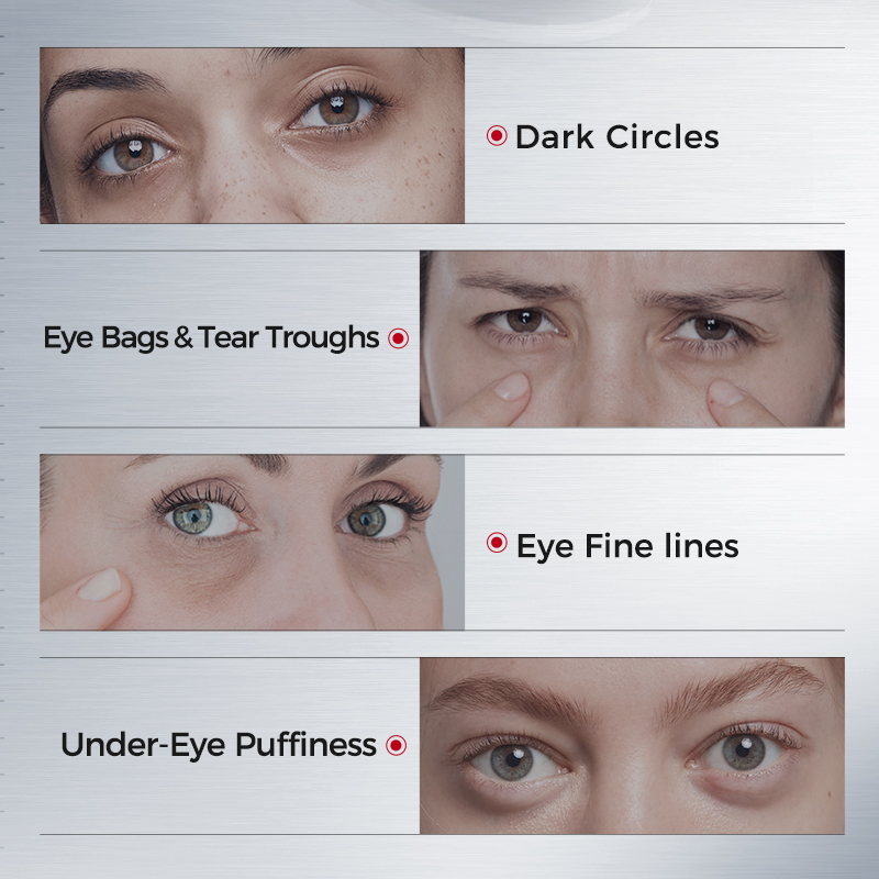 Eye Patches for Dark Circles – - Sheet Mask Collagen ulasan dan harga