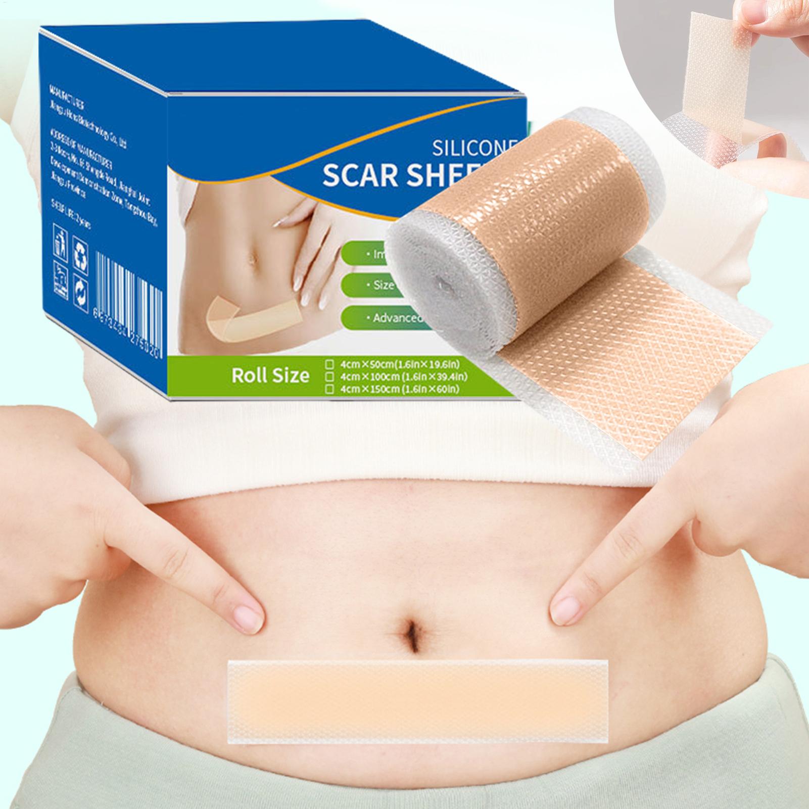 1 Roll Silicone Scar Sheets 4c - Sheet Mask Collagen ulasan dan harga